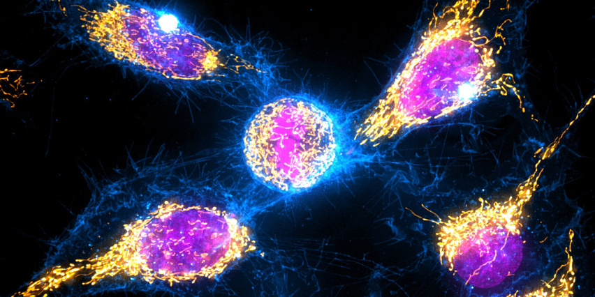 five cells actively dividing. each has a magenta nucleus surrounded by blue filaments. all but one are surrounded swaths of yellow mitochondria.