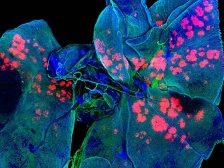 microscopic drug depots in the lungs